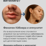 Герпес и витилиго